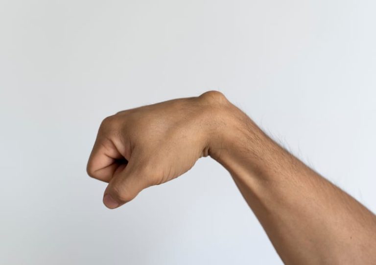 גנגליון, גושים וציסטות בכף היד (Ganglion & Hand Tumors)